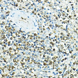 Invitrogen CD79a Polyclonal Antibody 100 &mu;L; Unconjugated:Antibodies,