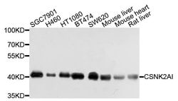 Invitrogen CK2 alpha-1 Polyclonal Antibody 100 &mu;L; Unconjugated:Antibodies,