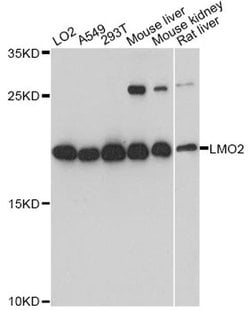 Invitrogen LMO2 Polyclonal Antibody 100 &mu;L; Unconjugated:Antibodies,