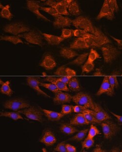 Invitrogen DAP5 Polyclonal Antibody 100 &mu;L; Unconjugated:Antibodies,