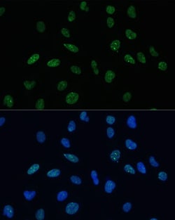 MKL1 Polyclonal Antibody:Antibodies, Polyclonal