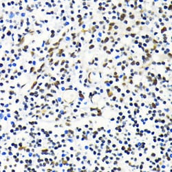 MKL1 Polyclonal Antibody:Antibodies, Polyclonal