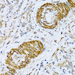 Invitrogen VAMP1 Polyclonal Antibody 100 &mu;L; Unconjugated:Antibodies,