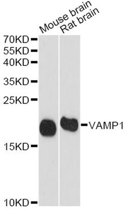 Invitrogen VAMP1 Polyclonal Antibody 100 &mu;L; Unconjugated:Antibodies,