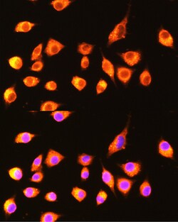 Invitrogen GBP2 Polyclonal Antibody 100 &mu;L; Unconjugated:Antibodies,