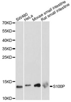 Invitrogen S100P Polyclonal Antibody 100 &mu;L; Unconjugated:Antibodies,