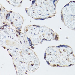 Invitrogen™ Adenosine Kinase Polyclonal Antibody