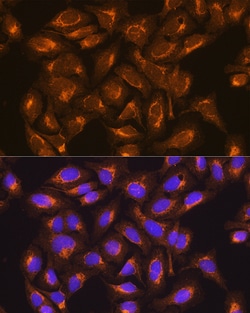 Invitrogen SDHB Polyclonal Antibody 100 &mu;L; Unconjugated:Antibodies,