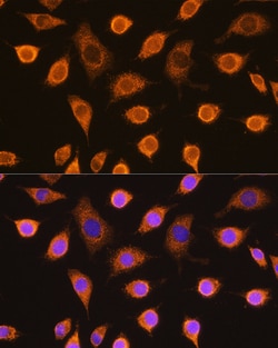 Invitrogen SDHB Polyclonal Antibody 100 &mu;L; Unconjugated:Antibodies,