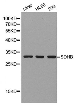 Invitrogen SDHB Polyclonal Antibody 100 &mu;L; Unconjugated:Antibodies,