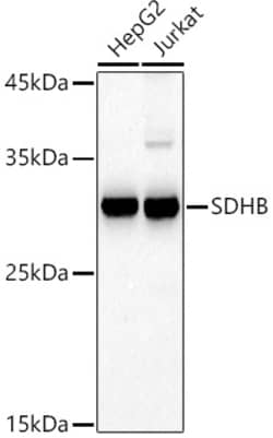 Invitrogen SDHB Polyclonal Antibody 100 &mu;L; Unconjugated:Antibodies,