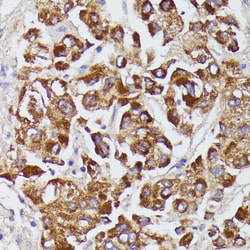 Angiotensinogen Polyclonal Antibody:Antibodies, Polyclonal