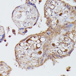 Angiotensinogen Polyclonal Antibody:Antibodies, Polyclonal