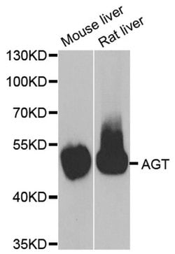 Angiotensinogen Polyclonal Antibody:Antibodies, Polyclonal