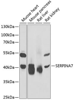 Invitrogen SERPINA7 Polyclonal Antibody 100 &mu;L; Unconjugated:Antibodies,