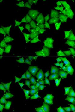 Invitrogen Aminoacylase Polyclonal Antibody 100 &mu;L; Unconjugated:Antibodies,