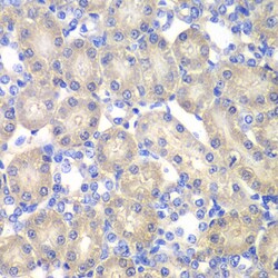 Invitrogen Aminoacylase Polyclonal Antibody 100 &mu;L; Unconjugated:Antibodies,