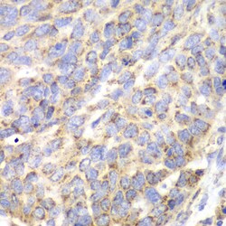Invitrogen Aminoacylase Polyclonal Antibody 100 &mu;L; Unconjugated:Antibodies,