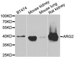 Arginase 2 Polyclonal Antibody:Antibodies, Polyclonal