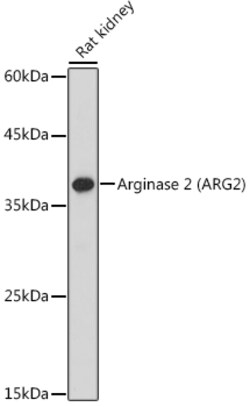 Arginase 2 Polyclonal Antibody:Antibodies, Polyclonal