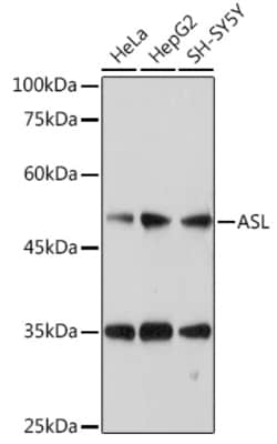 Invitrogen ASL Polyclonal Antibody 100 &mu;L; Unconjugated:Antibodies,