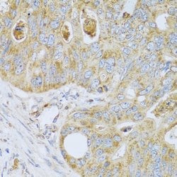 Invitrogen PSG1 Polyclonal Antibody 100 &mu;L; Unconjugated:Antibodies,