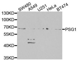 Invitrogen PSG1 Polyclonal Antibody 100 &mu;L; Unconjugated:Antibodies,