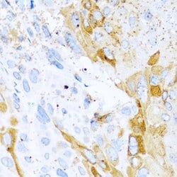 Invitrogen HAI-1 Polyclonal Antibody 100 &mu;L; Unconjugated:Antibodies,
