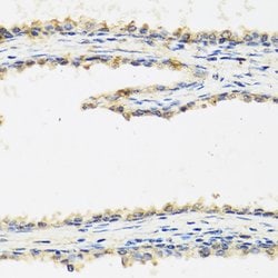 Invitrogen HAI-1 Polyclonal Antibody 100 &mu;L; Unconjugated:Antibodies,