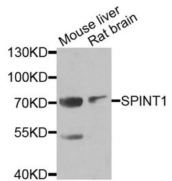 Invitrogen HAI-1 Polyclonal Antibody 100 &mu;L; Unconjugated:Antibodies,