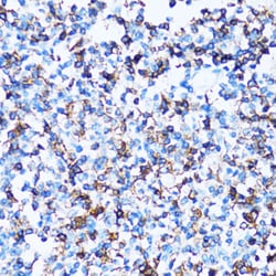 Invitrogen CD43 Polyclonal Antibody 100 &mu;L; Unconjugated:Antibodies,