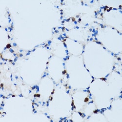 Invitrogen CD43 Polyclonal Antibody 100 &mu;L; Unconjugated:Antibodies,