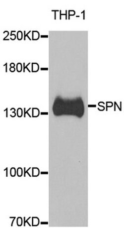 Invitrogen CD43 Polyclonal Antibody 100 &mu;L; Unconjugated:Antibodies,