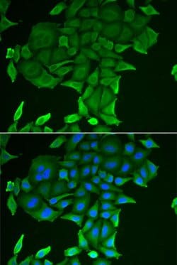 Invitrogen CD84 Polyclonal Antibody 100 &mu;L; Unconjugated:Antibodies,