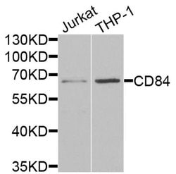 Invitrogen CD84 Polyclonal Antibody 100 &mu;L; Unconjugated:Antibodies,