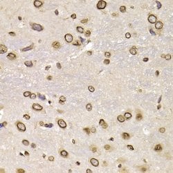 Invitrogen Lamin B2 Polyclonal Antibody 100 &mu;L; Unconjugated:Antibodies,