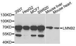 Invitrogen Lamin B2 Polyclonal Antibody 100 &mu;L; Unconjugated:Antibodies,