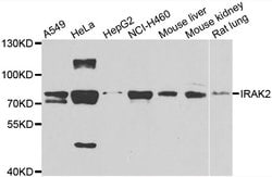 Invitrogen IRAK2 Polyclonal Antibody 100 &mu;L; Unconjugated:Antibodies,