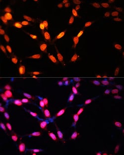 Invitrogen Myogenin Polyclonal Antibody 100 &mu;L; Unconjugated:Antibodies,