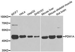 Invitrogen PPM1A Polyclonal Antibody 100 &mu;L; Unconjugated:Antibodies,