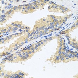 Invitrogen WFDC2 Polyclonal Antibody 100 &mu;L; Unconjugated:Antibodies,