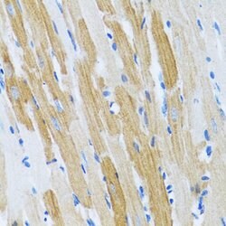 Invitrogen WFDC2 Polyclonal Antibody 100 &mu;L; Unconjugated:Antibodies,