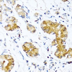 Invitrogen WFDC2 Polyclonal Antibody 100 &mu;L; Unconjugated:Antibodies,