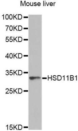 Invitrogen HSD11B1 Polyclonal Antibody 100 &mu;L; Unconjugated:Antibodies,
