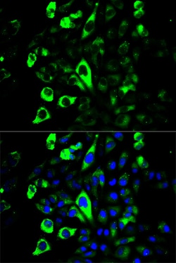 Invitrogen Granzyme B Polyclonal Antibody 100 &mu;L; Unconjugated:Antibodies,