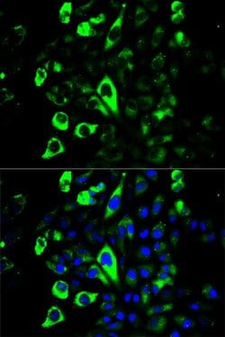 Invitrogen Granzyme B Polyclonal Antibody 100 &mu;L; Unconjugated:Antibodies,
