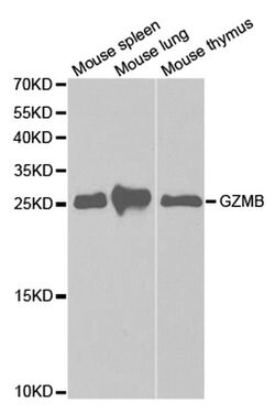 Invitrogen Granzyme B Polyclonal Antibody 100 &mu;L; Unconjugated:Antibodies,