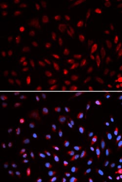 Invitrogen ERCC1 Polyclonal Antibody 100 &mu;L; Unconjugated:Antibodies,