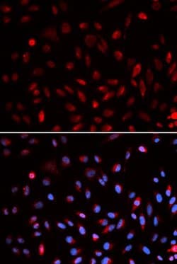Invitrogen ERCC1 Polyclonal Antibody 100 &mu;L; Unconjugated:Antibodies,
