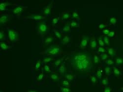 Invitrogen ERCC1 Polyclonal Antibody 100 &mu;L; Unconjugated:Antibodies,